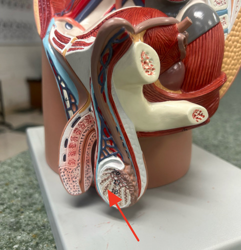 <p>coiled sperm-producing tubes within the lobules of the testis</p>
