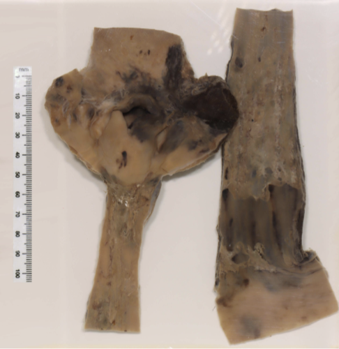 <p>Identify the POT</p>
