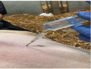 <ul><li><p>insert needle</p></li><li><p>put a little local anesthetic into top of needle</p></li><li><p>drop should disappear</p><ul><li><p>if in right space bcuz of negative pressure and ‘vacuum’ inside space</p></li></ul></li></ul><p></p>