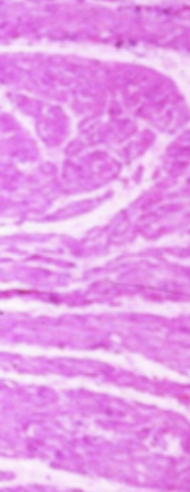 <p>Identify the histology of the heart</p>