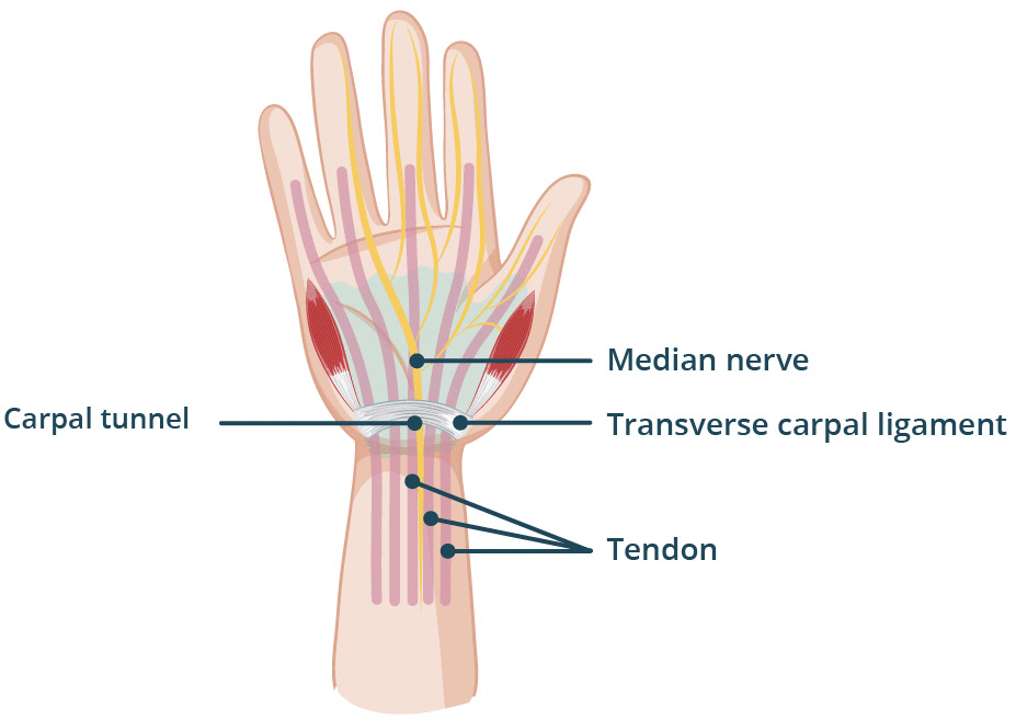 <p>Brachial Plexus Injuries - <strong>Carpal Tunnel</strong></p>