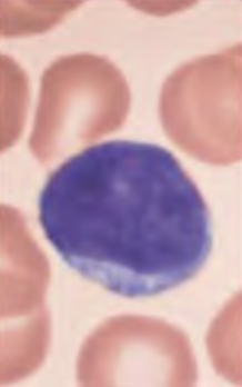 <p>What blood cell is this?</p>