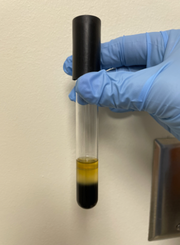 <p>Is the bacteria in the picture positive or negative for motility?</p>