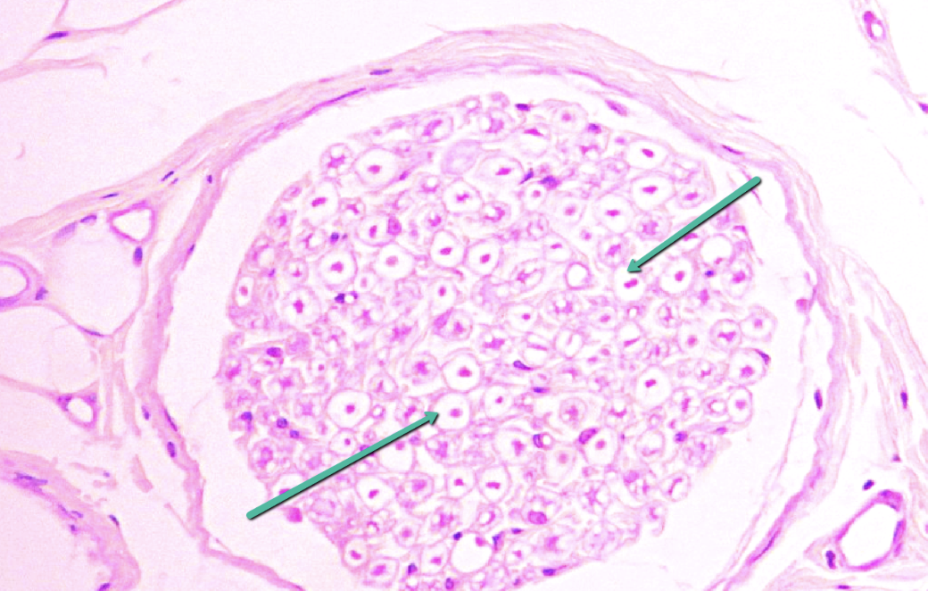 <p><strong>PNS</strong></p><p>Identify the white structures (not cells) indicated by the pointers.</p>