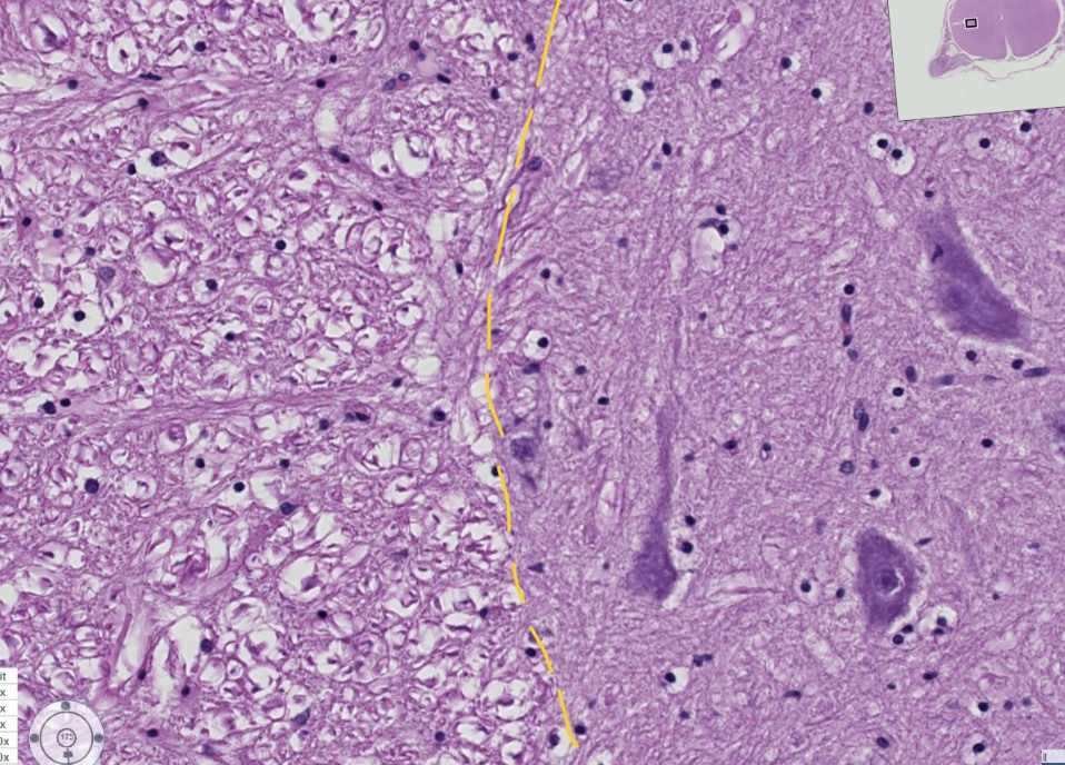 <p>within this spinal cord, ID the types of matter (grey or white) to the left and right of the dashed yellow line</p>