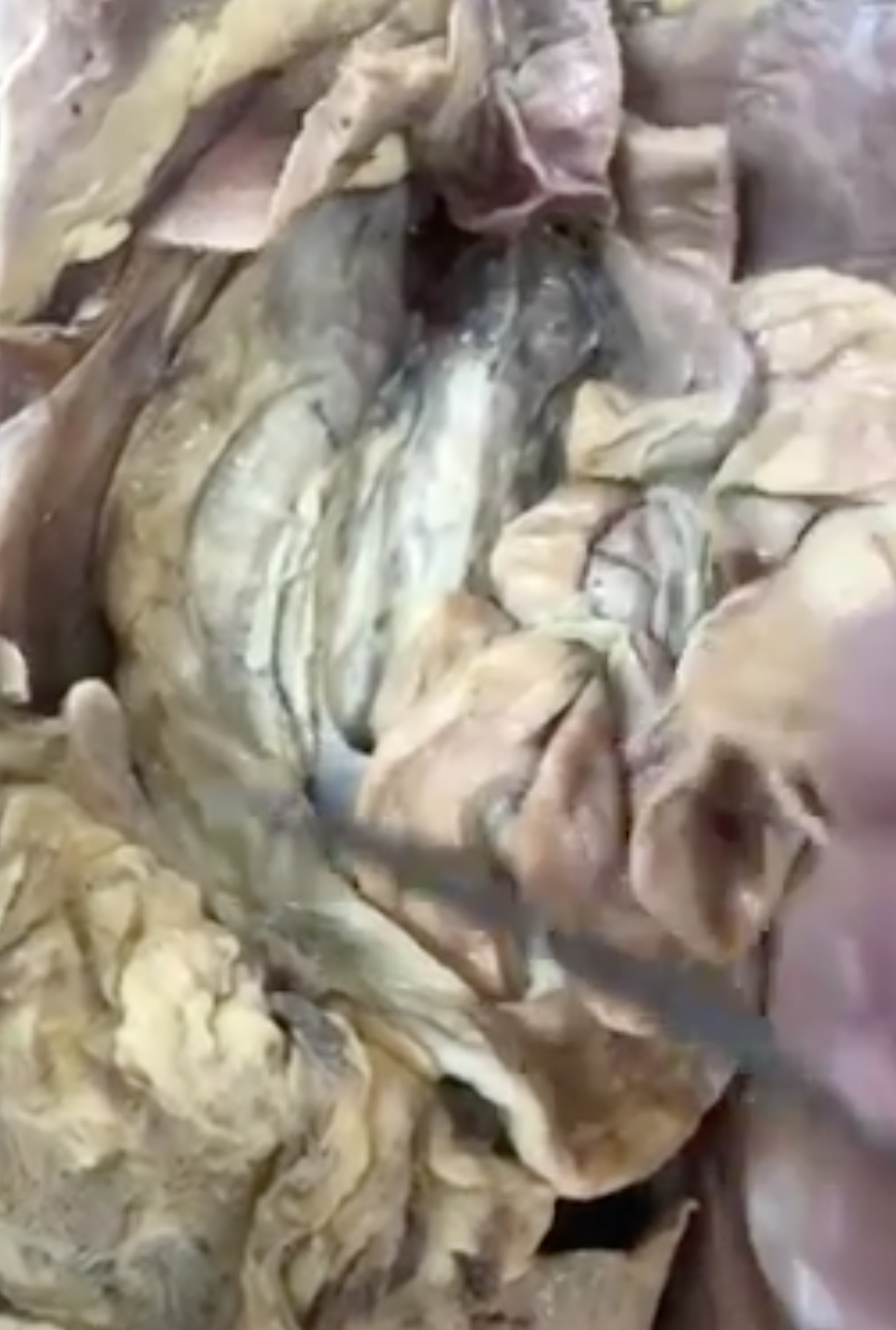 <p>what is the end region of the intestines prong is pointing to</p>