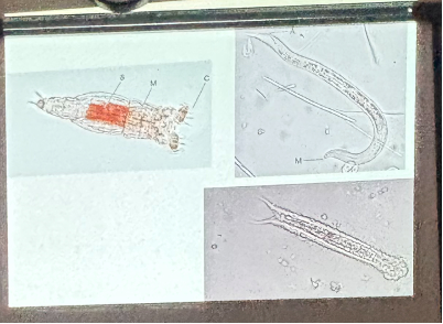 <p>What is this organism?</p>