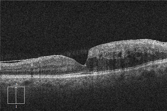 term image