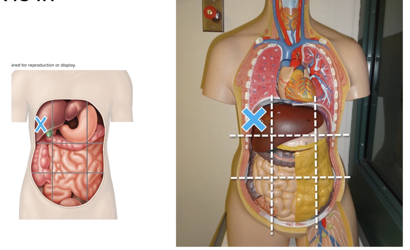 <p>Name the abdominopelvic region the mark is in</p>
