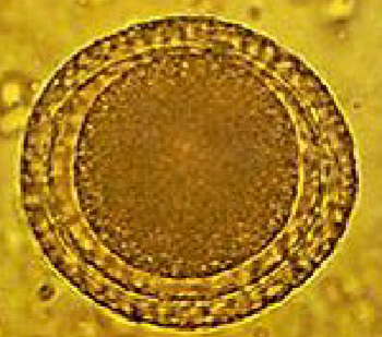 <p>What eggs are these?</p>