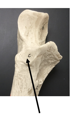 <p>What bone and bone feature is this?</p>