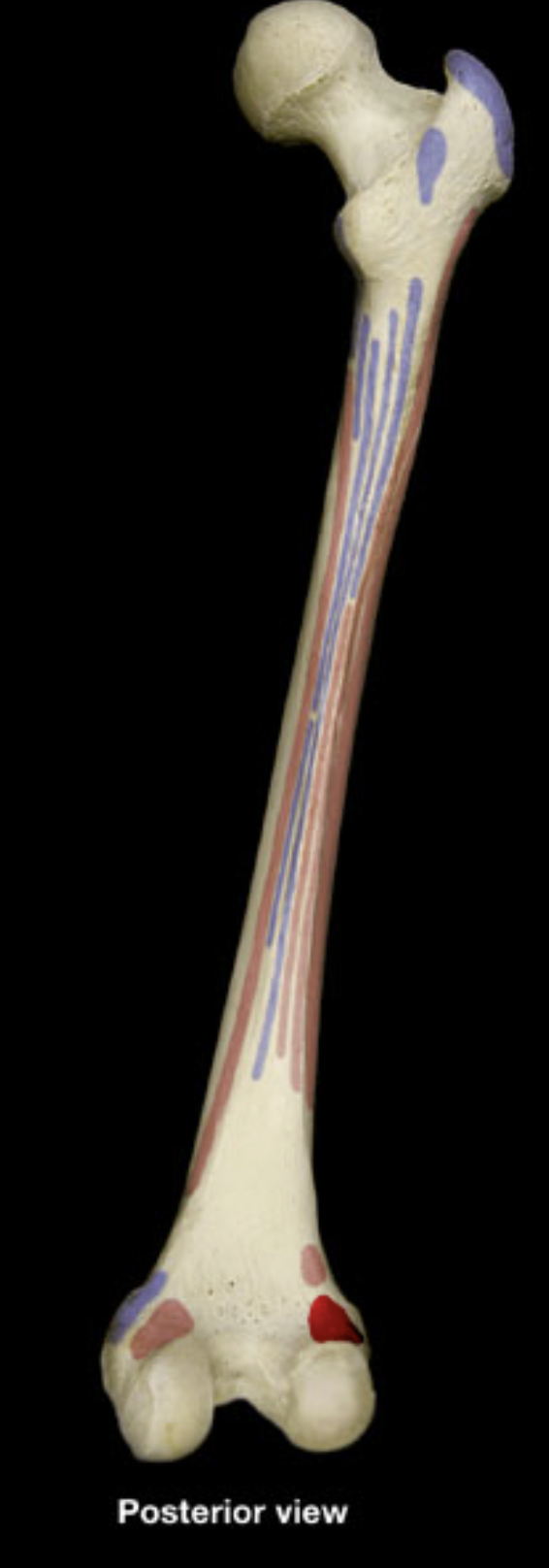 <p>lateral condyle of femur</p>