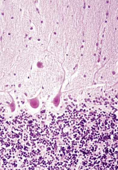 <p>What are the fibers seen in the cerebellum?</p>