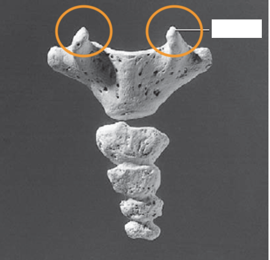 <p>Coccygeal: What is the Orange?</p>