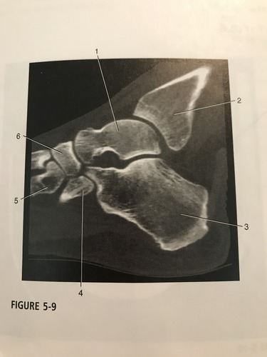 <p>Number 1 corresponds to which of the following?</p><p>A) navicular </p><p>B) cuboid</p><p>C) calcaneus</p><p>D) talus</p>