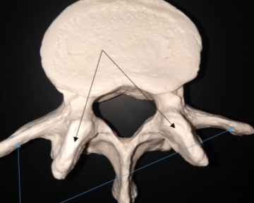 <p>What are the black arrows pointing at?</p>