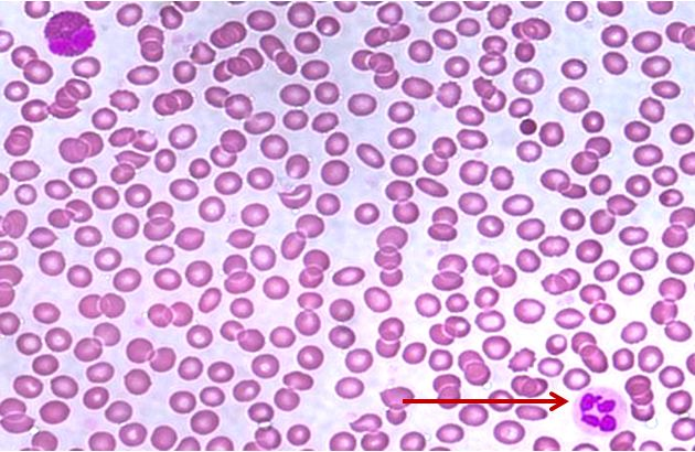 <p>Tế bào gì ?</p>