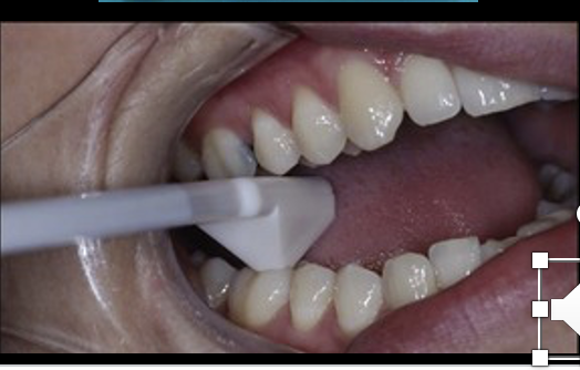 <p>goal of using a tooth slooth </p>
