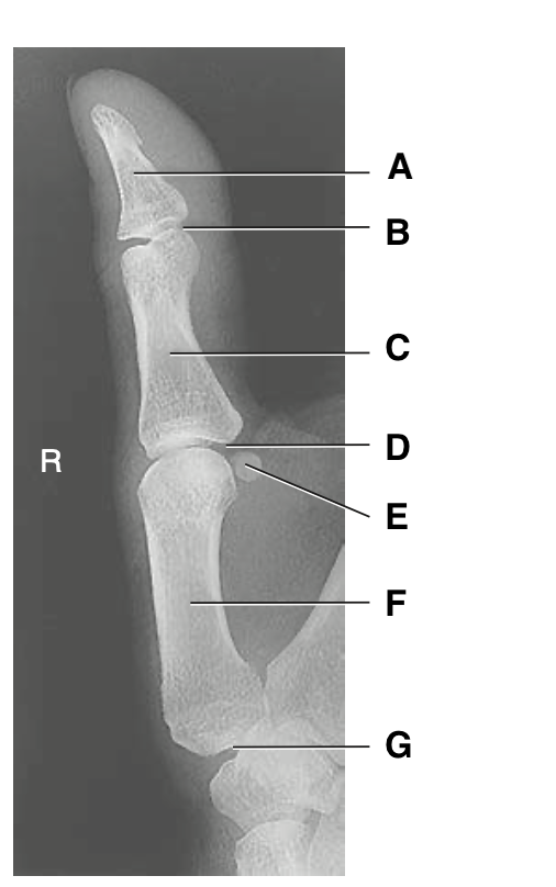 <p>E</p>