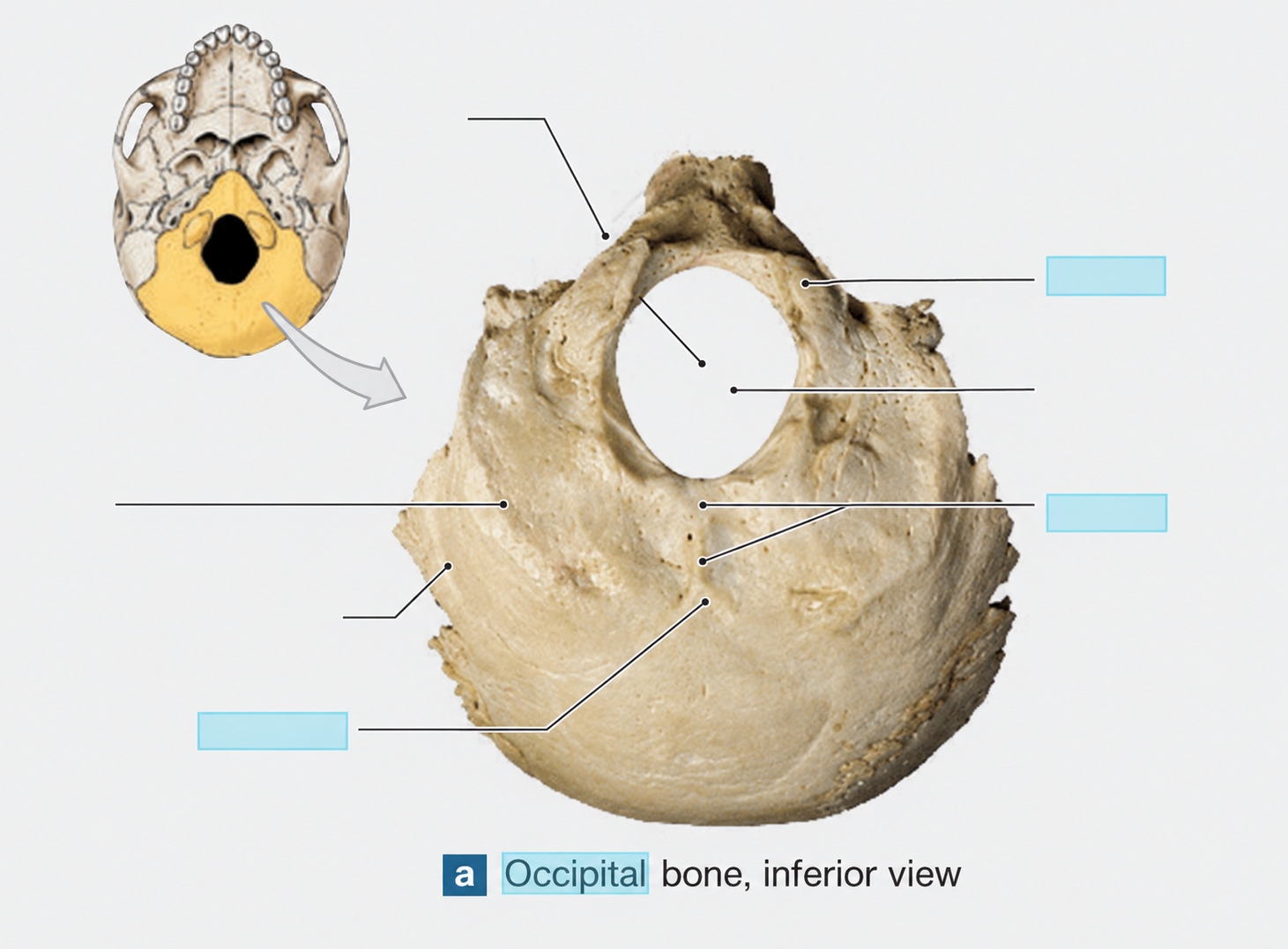 <p>Name the Bones (3)</p>