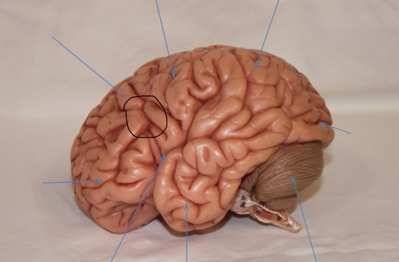 <p>Identify the circled area?</p>