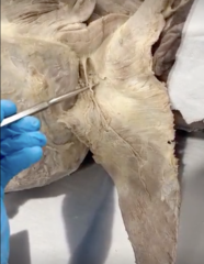 <p>Name the structure</p><p>- underneath transverse cervical artery</p>