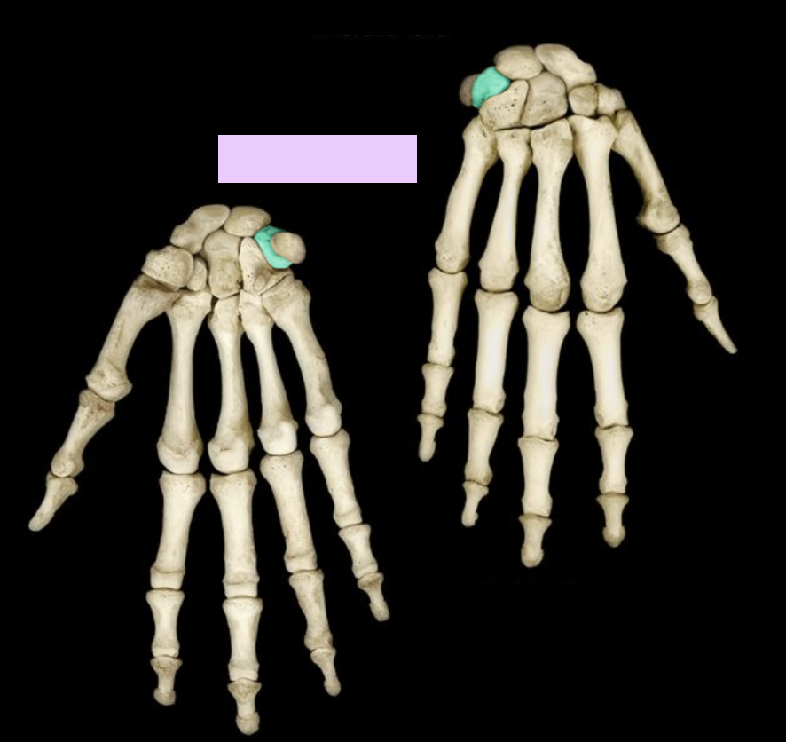 <p>What structure is highlighted?</p>