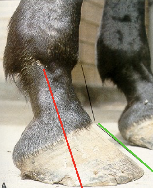<ul><li><p>long toe, under-run heel</p></li><li><p>common defect</p></li><li><p>often caused by poor foot care</p></li><li><p>result in increased strain on the deep digital flexor &amp; delayed break-over</p></li></ul><p></p>
