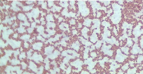 <p>Bacteria Species: </p><p>Endospore +/ - : </p><p></p>