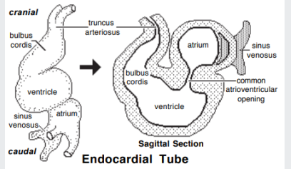 <p>dividing ventricles (<span style="color: purple;">interventricular septum)</span></p>