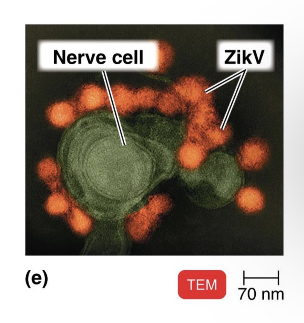 <p>virus</p>