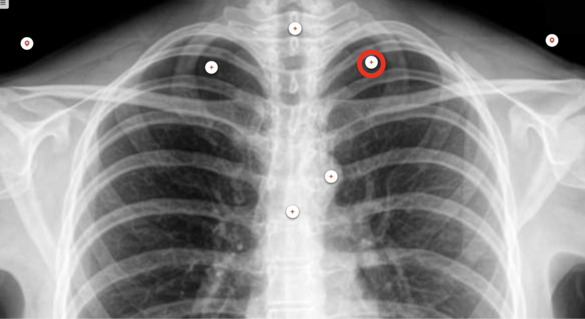 <p>what structure is the red circle labeling?</p>