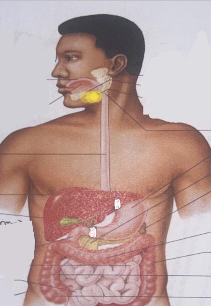 term image