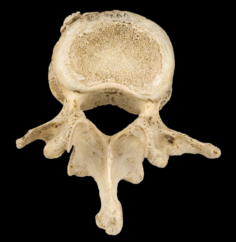 <p>What type of bone is this</p>