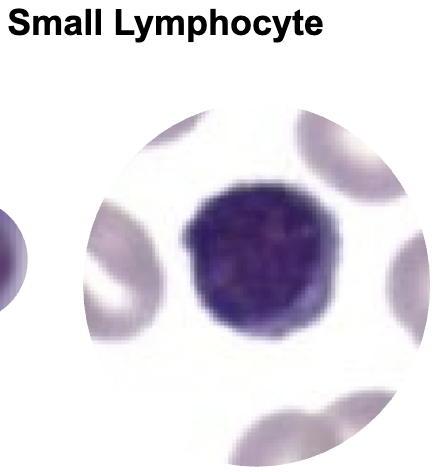 <p>Lymphocytes</p>