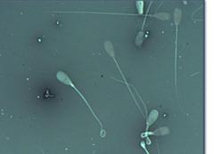 <p>What is this? Normal or abnormal sperm?</p>