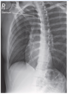 <p><span style="background-color: transparent;">attempt at OBL ribs</span></p>