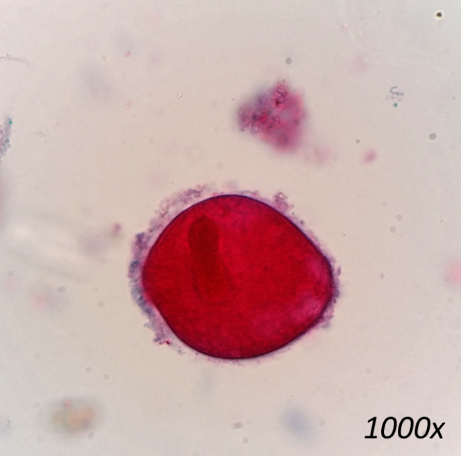<p>What organism is this, and is it a trophozoite or a cyst?</p>