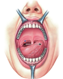 knowt flashcard image