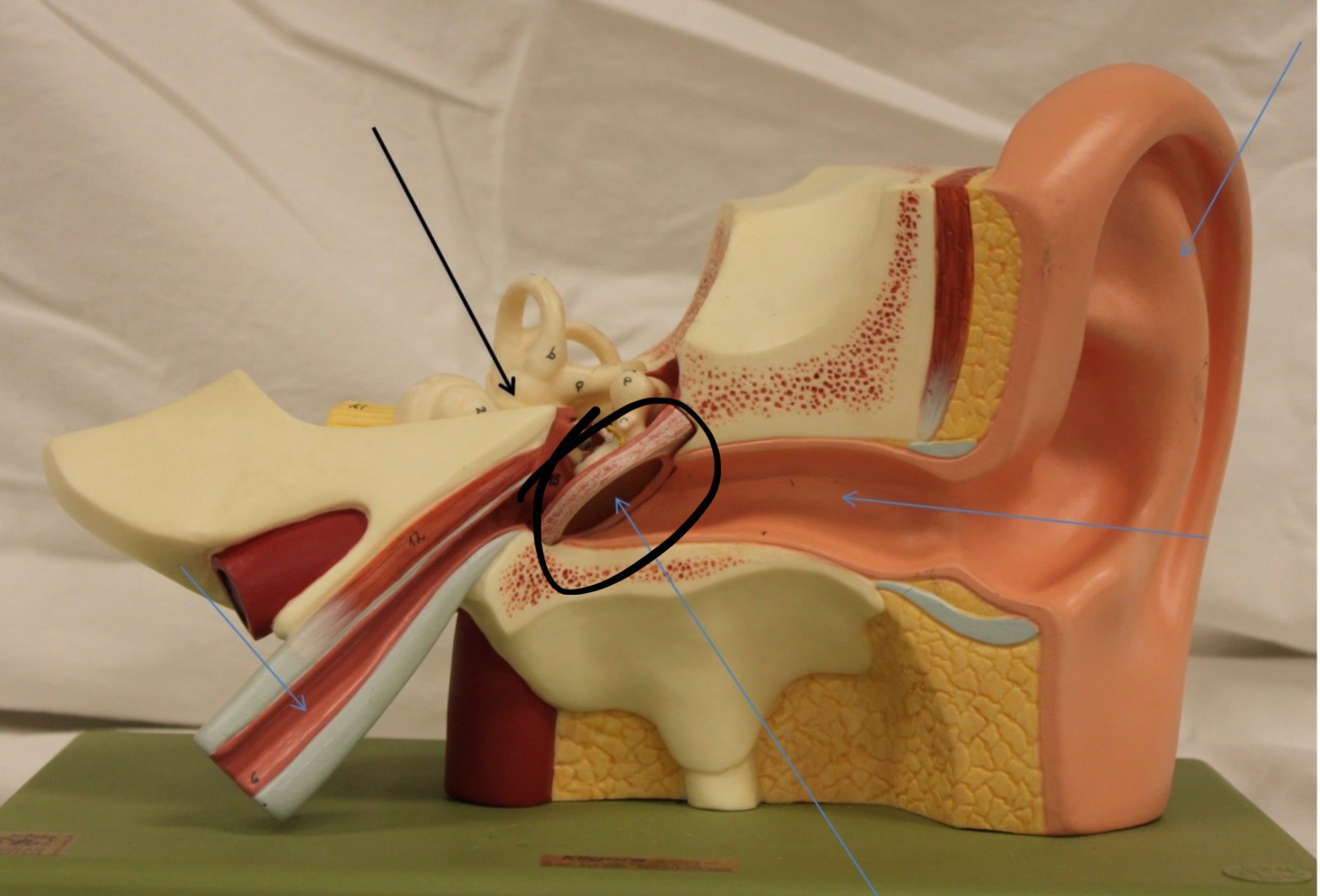 <p>Identify the circled area?</p>