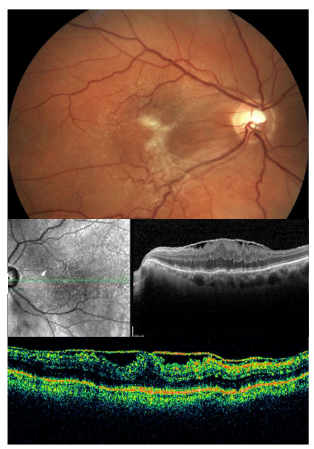 <p>Name the condition</p>