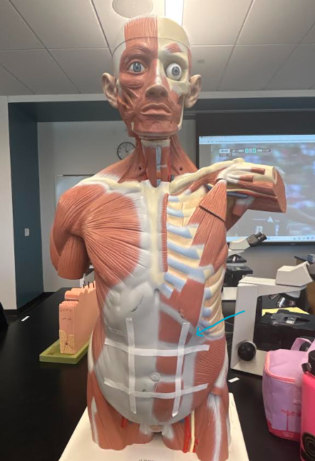 <p>ID abdominopelvic region</p>