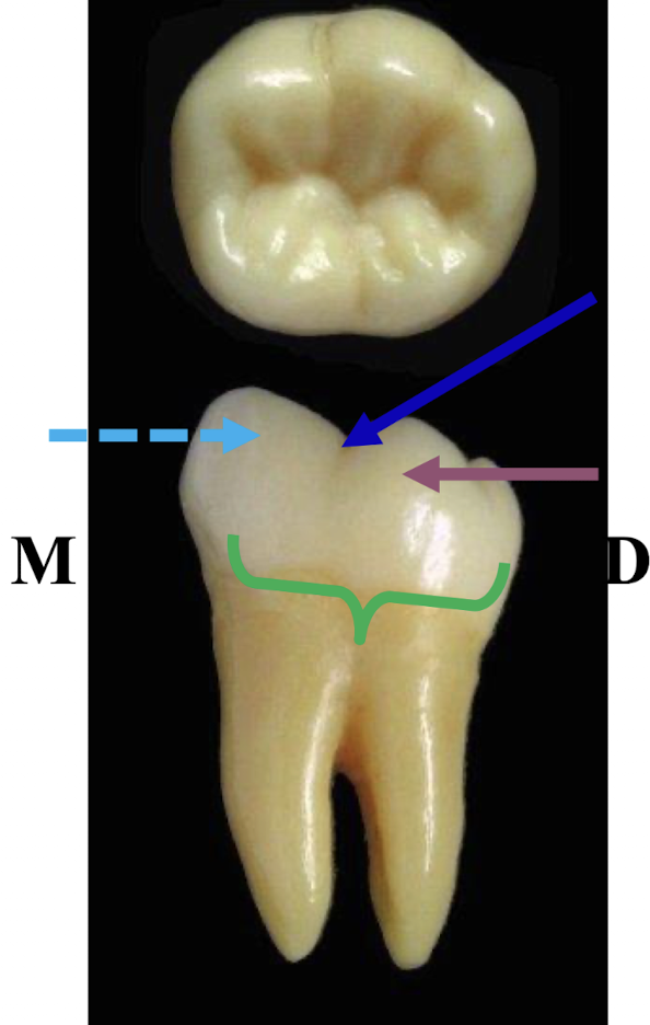 <p>occlusal outline</p><ul><li><p>formed by 2 lingual cusps </p></li><li><p><span style="color: rgb(8, 234, 255);">ML</span>, <span style="color: rgb(126, 0, 255);">DL </span>of nearly equal length </p></li></ul><p><span style="color: rgb(0, 255, 24);">cervical outline</span></p><ul><li><p>irregular with dipping into root bifurcation</p></li></ul><p>anatomical landmarks</p><ul><li><p><span style="color: rgb(58, 61, 255);">lingual developmental groove </span></p></li></ul><p></p>