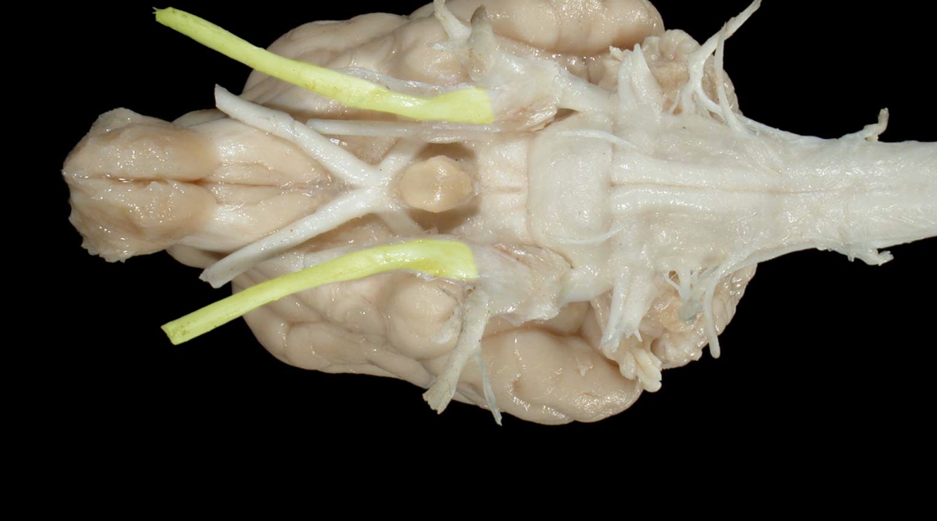 <p>what nerve is this and branch </p>