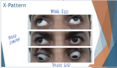 <p>X Pattern (Pic)</p>