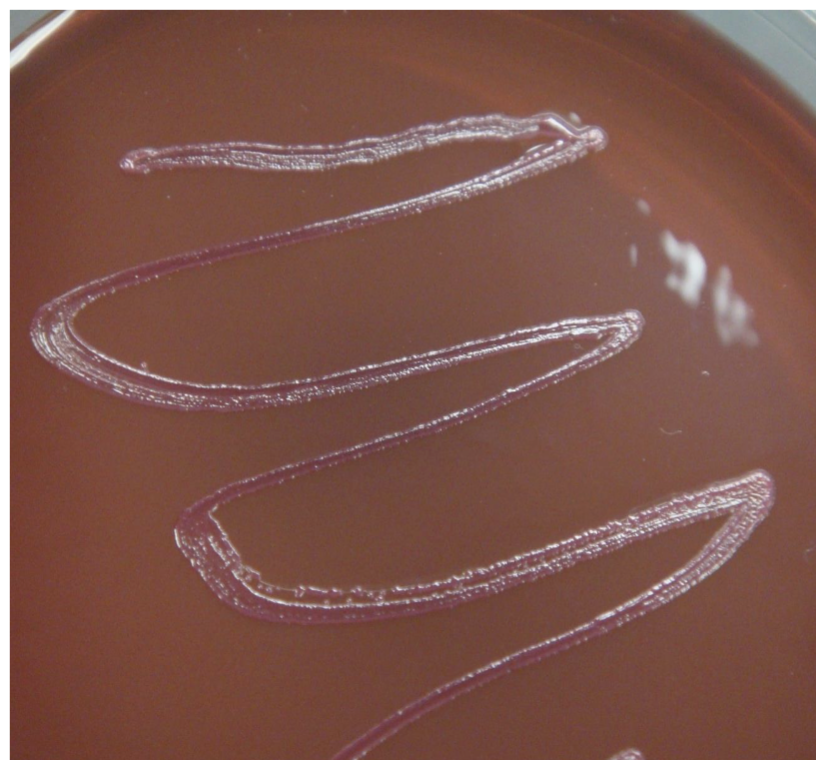 <p><span data-name="pink_heart" data-type="emoji">🩷</span> PINK / RED </p><p>EMB</p>