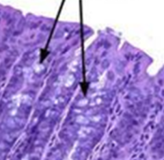 <p>what cells are arrows pointing to (colon)</p>