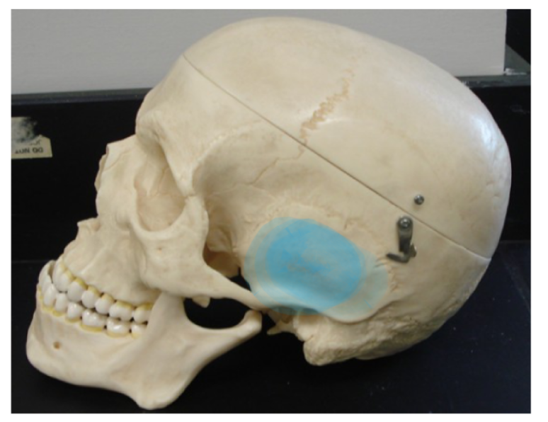 <p>What part of the skull is this? </p>