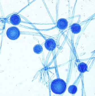 <p>Sporangiospores (sack of spores)</p>