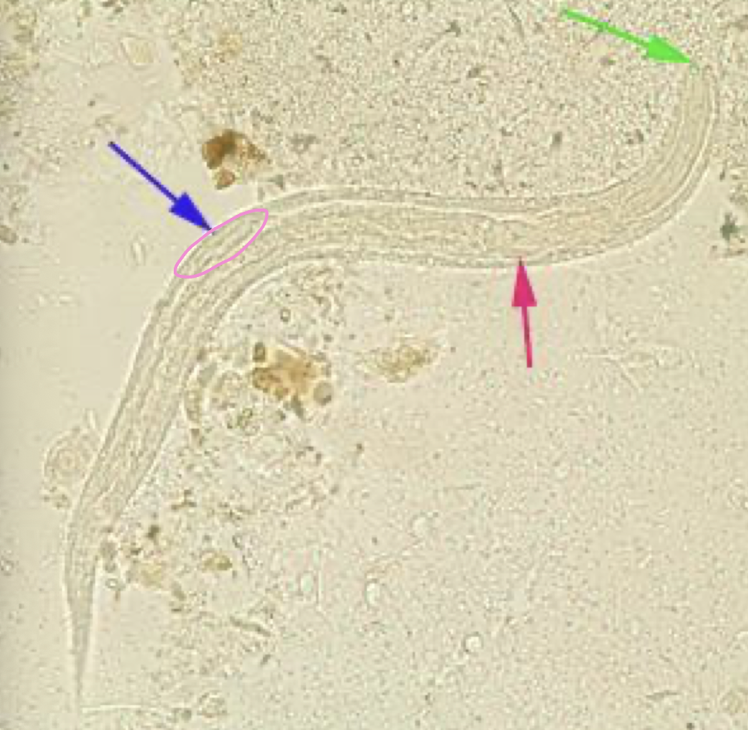 <p>what helminth is this?</p>